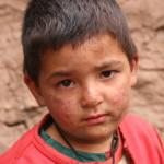 Foto 2 - Adozione bambini dell'immondizia